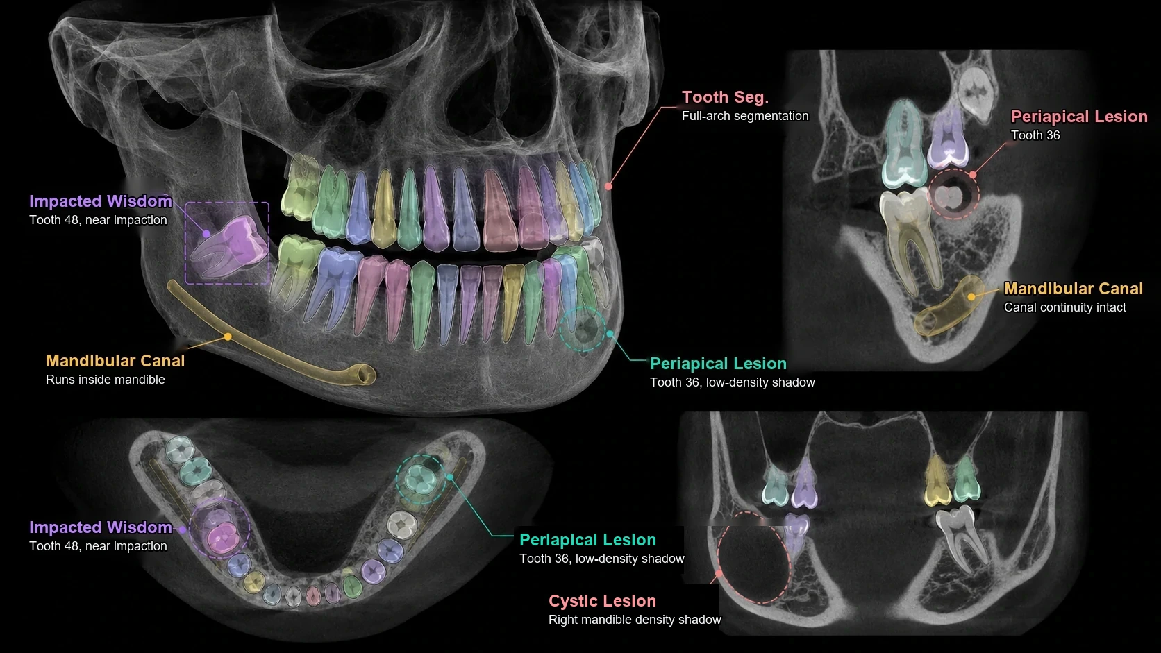 CBCT Detection and Segmentation